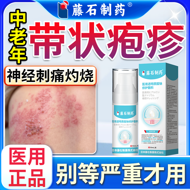 带状疱疹真菌瘙痒蛇缠腰水泡型止痛后遗神经痛灼烧感理疗喷雾剂Q8