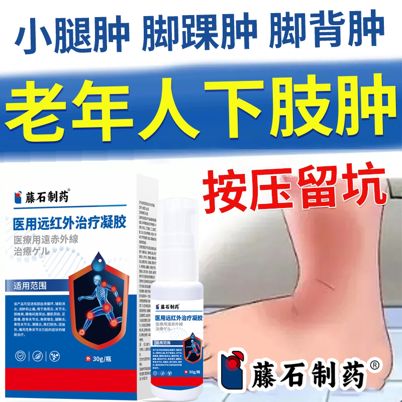 老人下肢肿腿脚水肿浮肿肿胀酸胀无力藤石制药消肿止痛医用凝胶RW