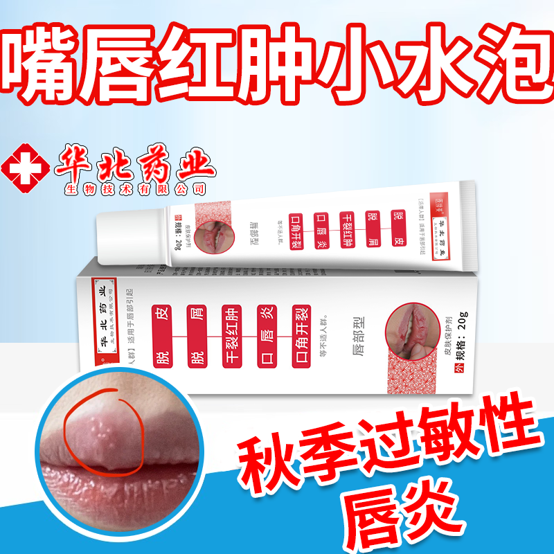 嘴唇红肿水泡糜烂渗出结痂瘙痒刺痛脱皮干燥开裂秋季过敏性唇炎rw