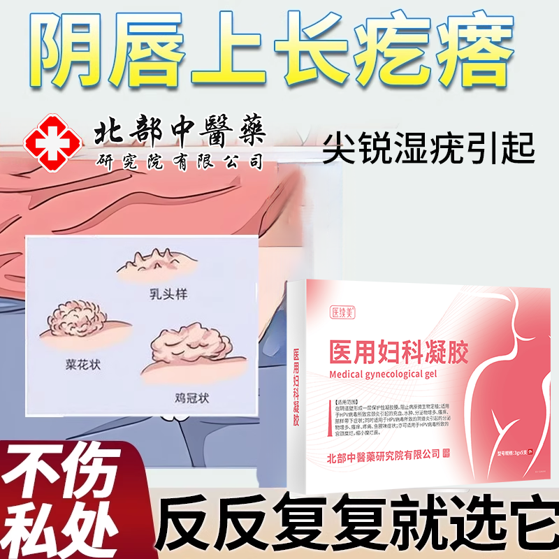 外阴唇上长疙瘩私处疣长痘女性私处hpv尖锐湿疣康膏净灵小假性RW