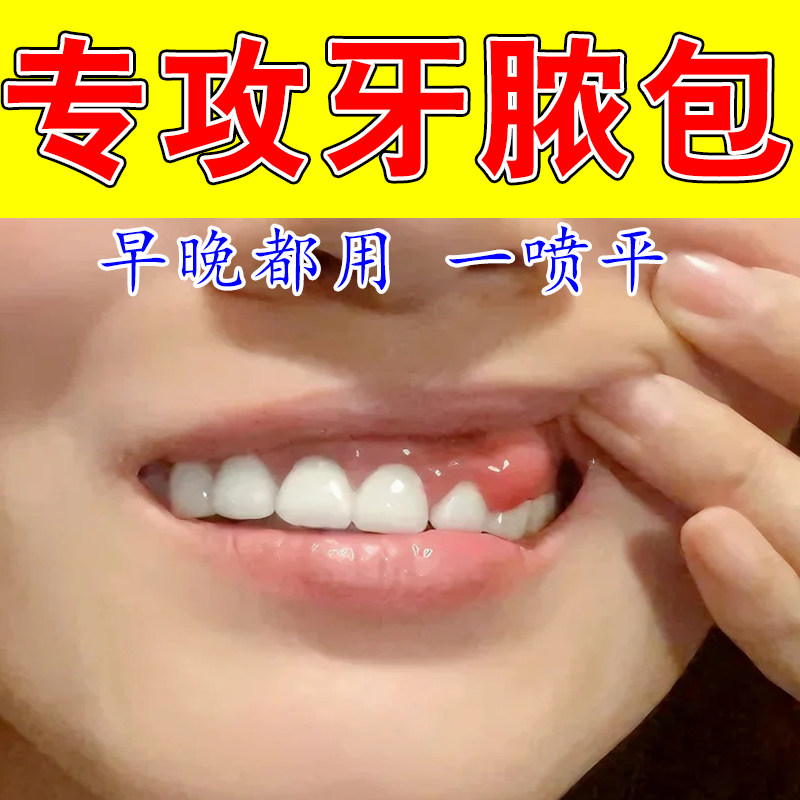 牙龈肿痛脓包专用口腔上火牙周息肉增生红肿起泡舒缓修护喷剂