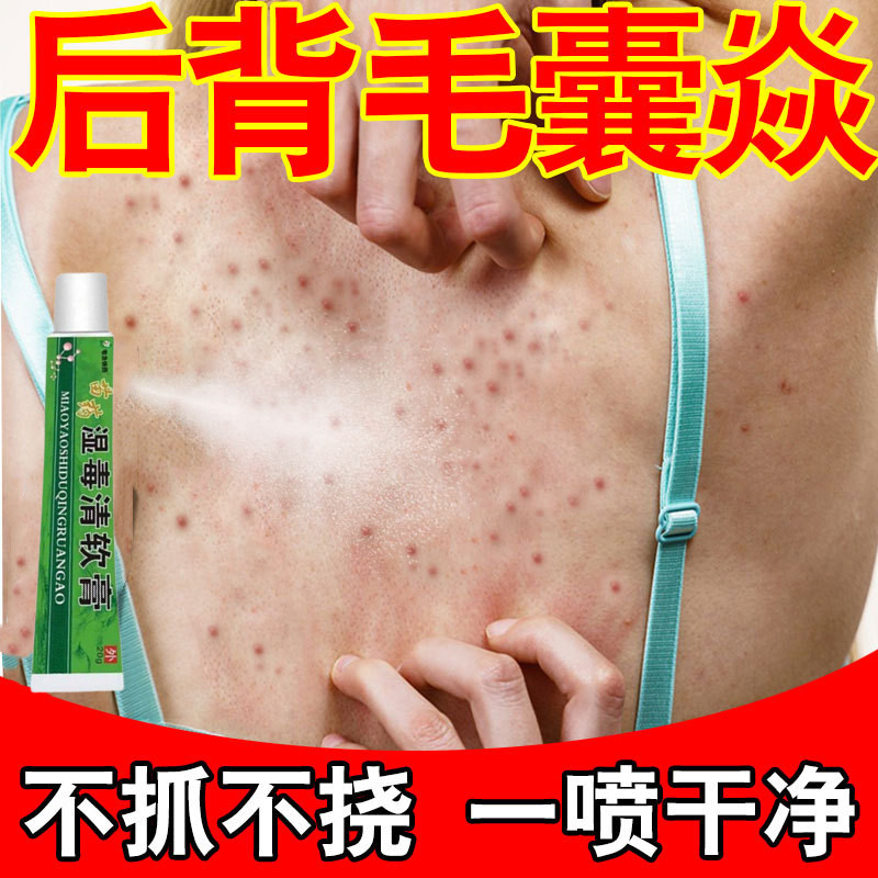 毛囊焱专用后背长痘前胸肩颈脖子痘痘后脑勺有疙瘩痤疮专用喷雾剂