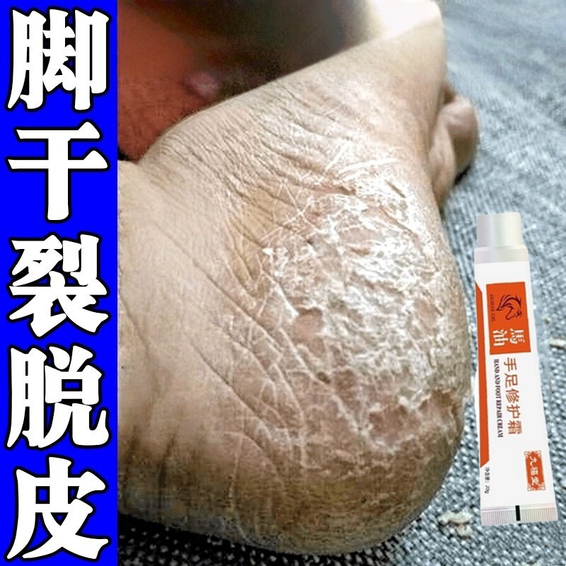 脚后跟干裂起硬皮足跟开裂修复霜手足皮干裂真菌去干皮膏