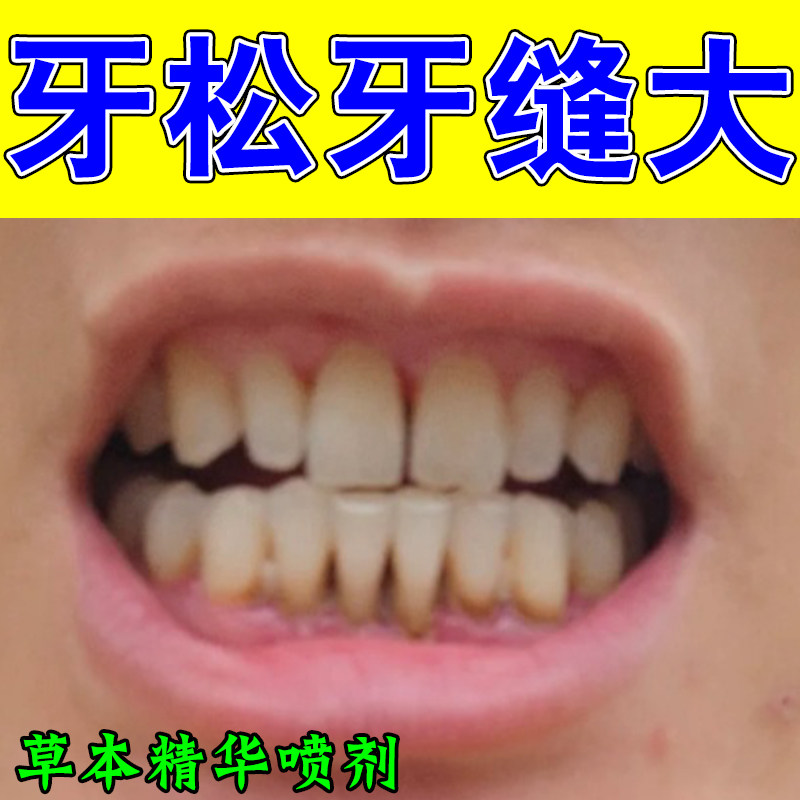牙齿牙龈萎缩牙不稳牙龈萎缩红肿牙龈日常出血专用牙周护养喷剂