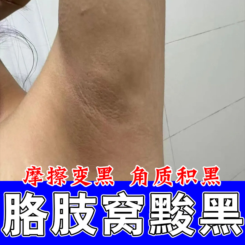 腋下肌肤粗糙腋窝颜色发黑胳肢窝褶皱暗沉腋下老废角质堆积按摩膏