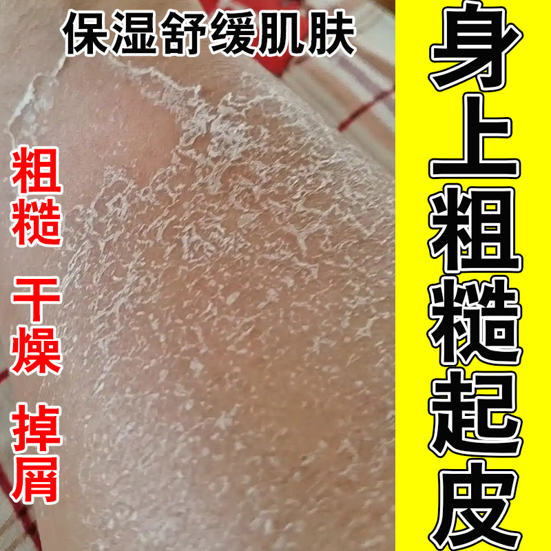 冶小腿干燥起皮皮肤粗糙掉屑起皮肤保湿补水新西兰身体甘油