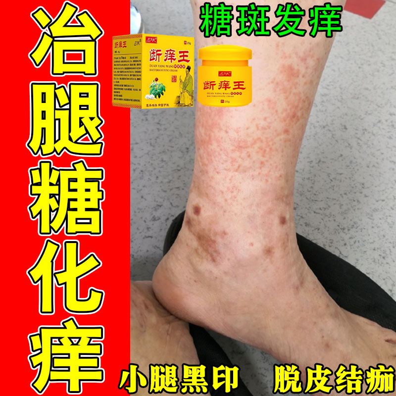 肌肤糖斑暗沉色素沉淀全身皮肤干燥脱皮反复疼痒不适修护植萃膏