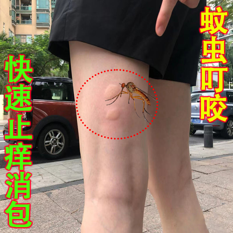 驱蚊止痒膏蚊虫叮咬止痒消肿婴儿成人儿童止痒凝露百草止痒抑菌膏