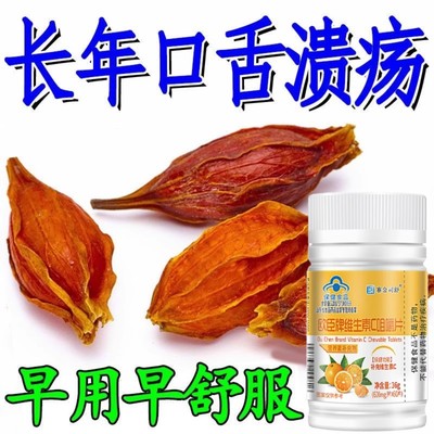 经常上火】欧臣牌维生素C咀嚼片营养素高含量清热去火去五脏之火