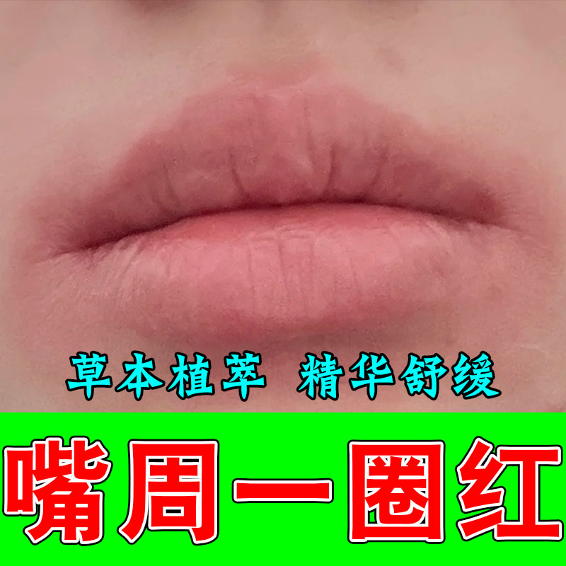 小孩爱舔嘴唇嘴周泛红干疼起泡起皮羊胡子植物萃取舒缓修护软膏