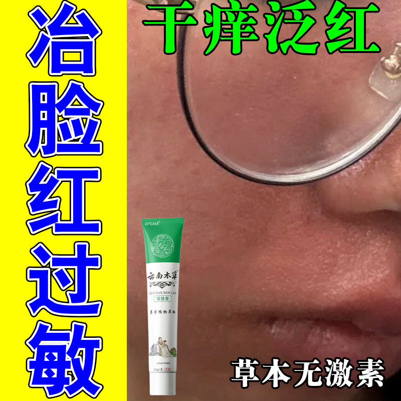 面部反复发红干痒红肿脱屑冷热刺激敏感发烫植萃舒缓修护膏
