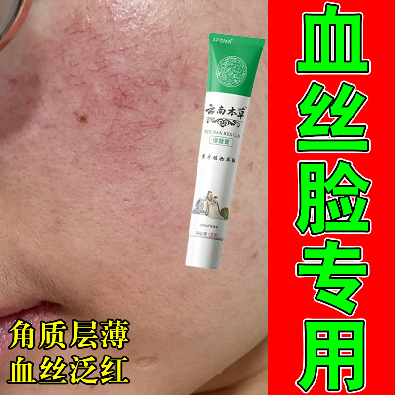 红血丝修复角质层改善敏感肌肤增厚修复脸部泛红保湿舒缓植物膏