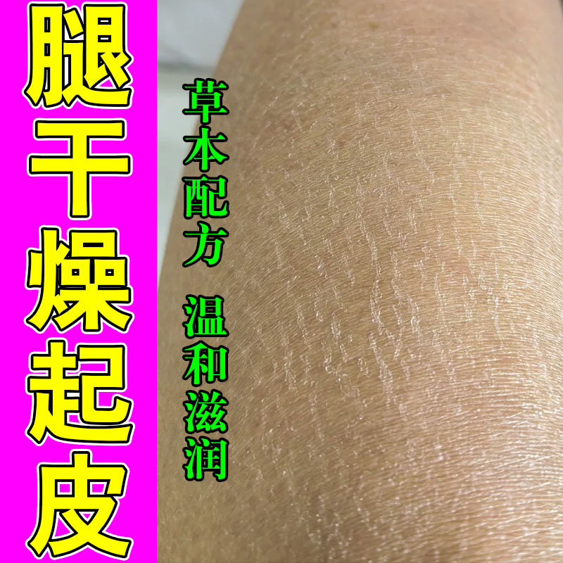 冶身体干燥鱼鳞肤腿部疙瘩皮肤干燥起皮身体滋润草本甘油