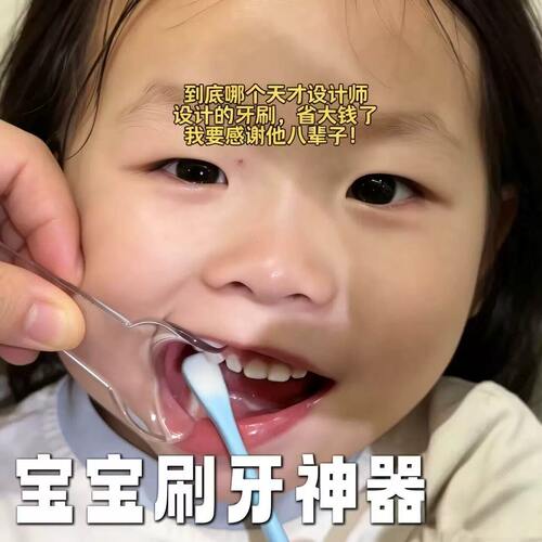 宝宝刷牙神器！儿童口腔开口器辅助刷牙扩充器牙齿污垢清洁小工具