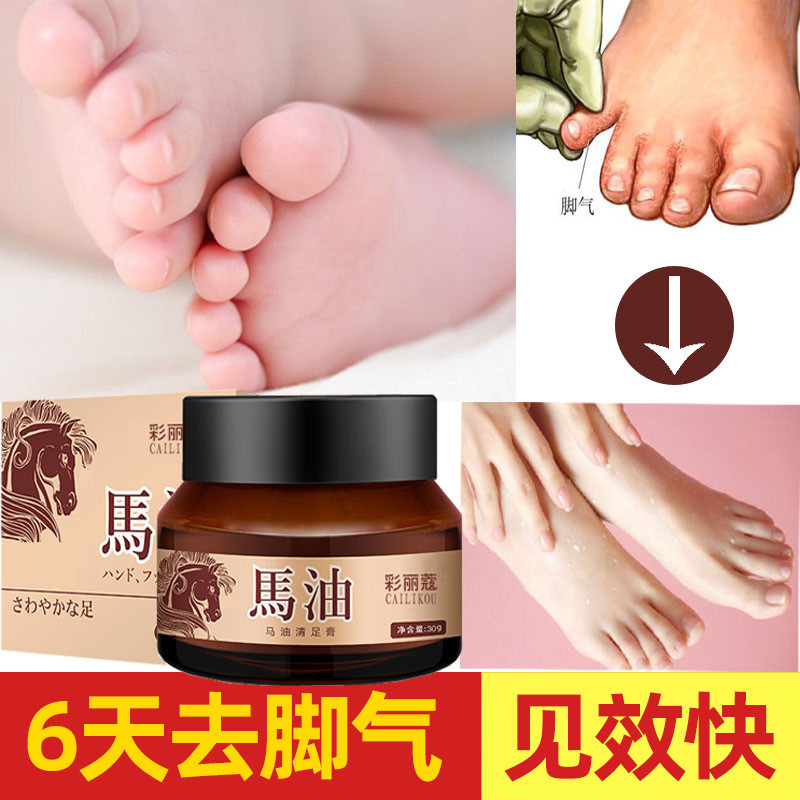 日本马油脚气膏快速见效去脚臭脚痒脚汗烂脚丫清足膏防裂膏防冻