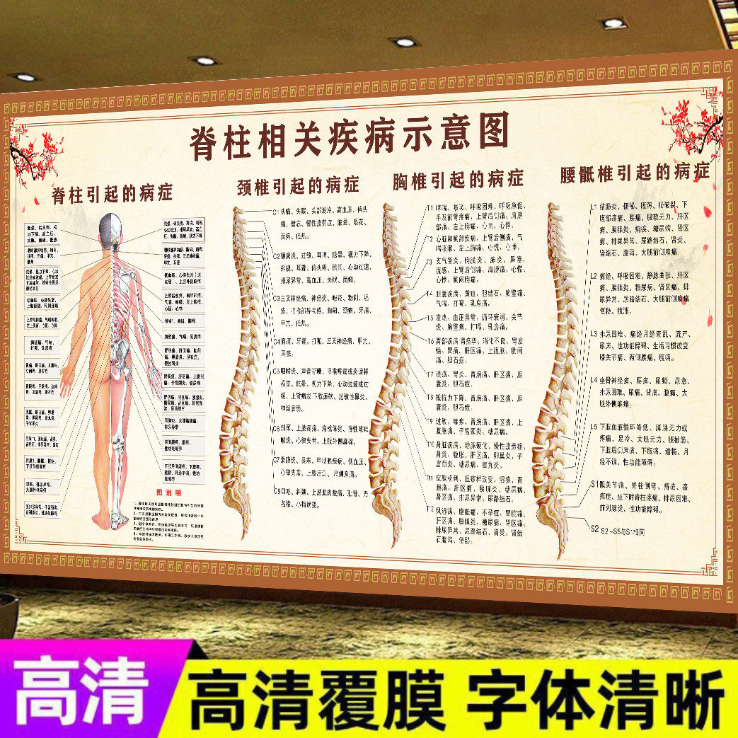 脊柱脊椎相关疾病示意图脊椎腰椎引起的病症画理疗养生馆正骨挂图
