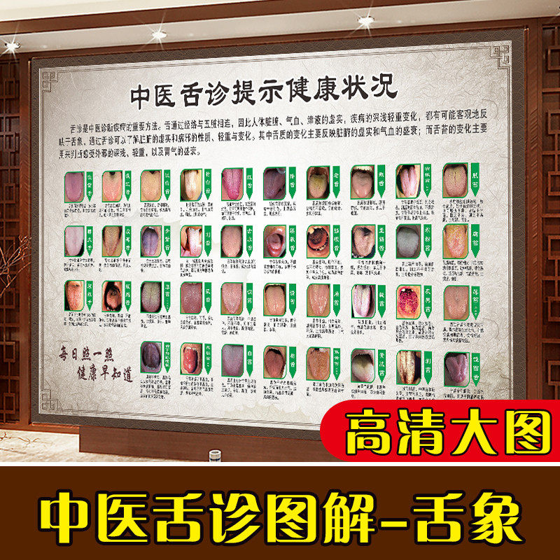 中医舌诊辩证图解挂图海报口腔舌头健康状况图谱贴画养生装饰画