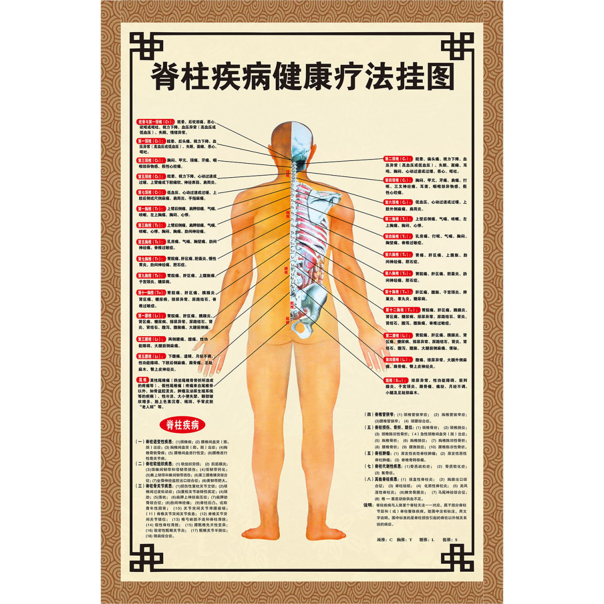 脊柱疾病健康疗法挂图海报展板脊柱关节错位临床症状示意图墙贴纸