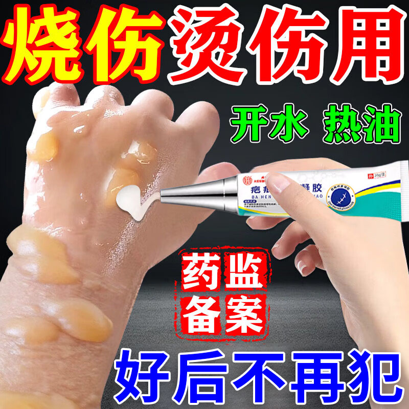 油溅烫伤膏药淡化疤痕去黑印色素沉淀修复儿童疤增生疙瘩热油烧伤