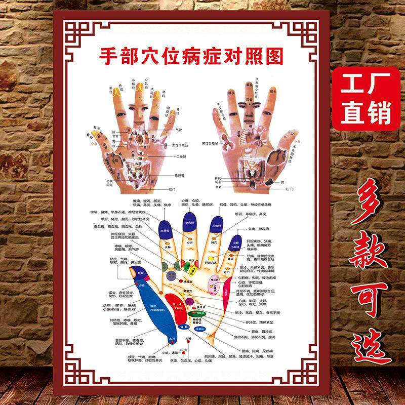 手部穴位图中医养生宣传画手心手掌手背经络穴位挂图反射区病症图