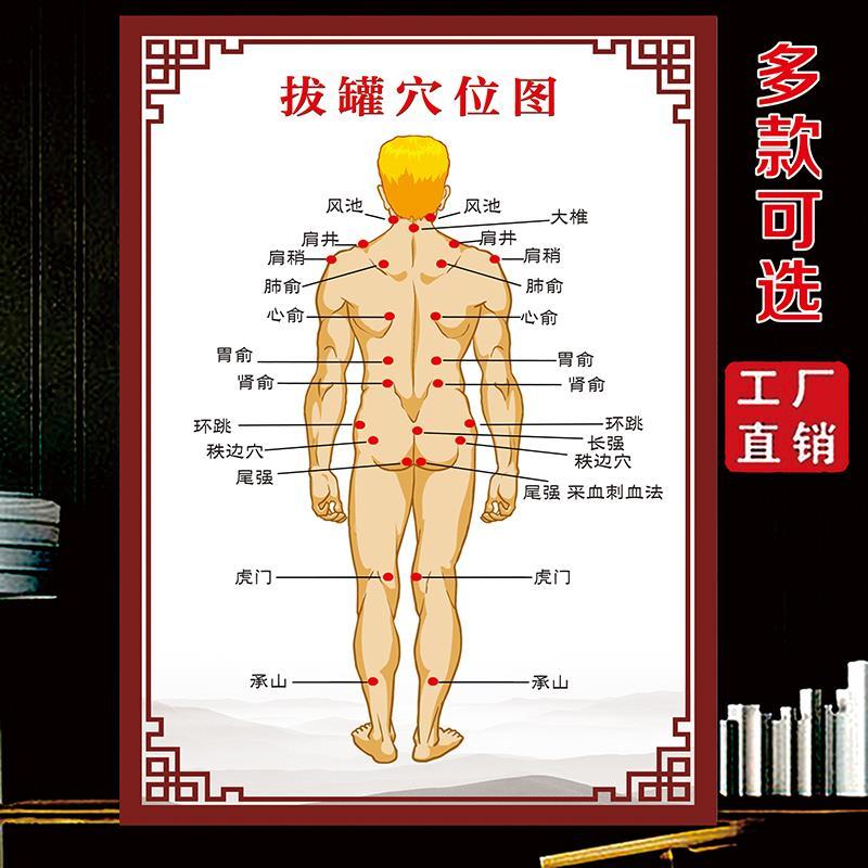 拔罐穴位图拔罐的好处宣传画美容院养生馆装饰画贴画理疗店海报
