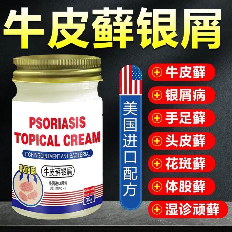美国牛皮癣银屑癣蚊虫叮咬止痒膏头皮癣湿疹手足藓膏