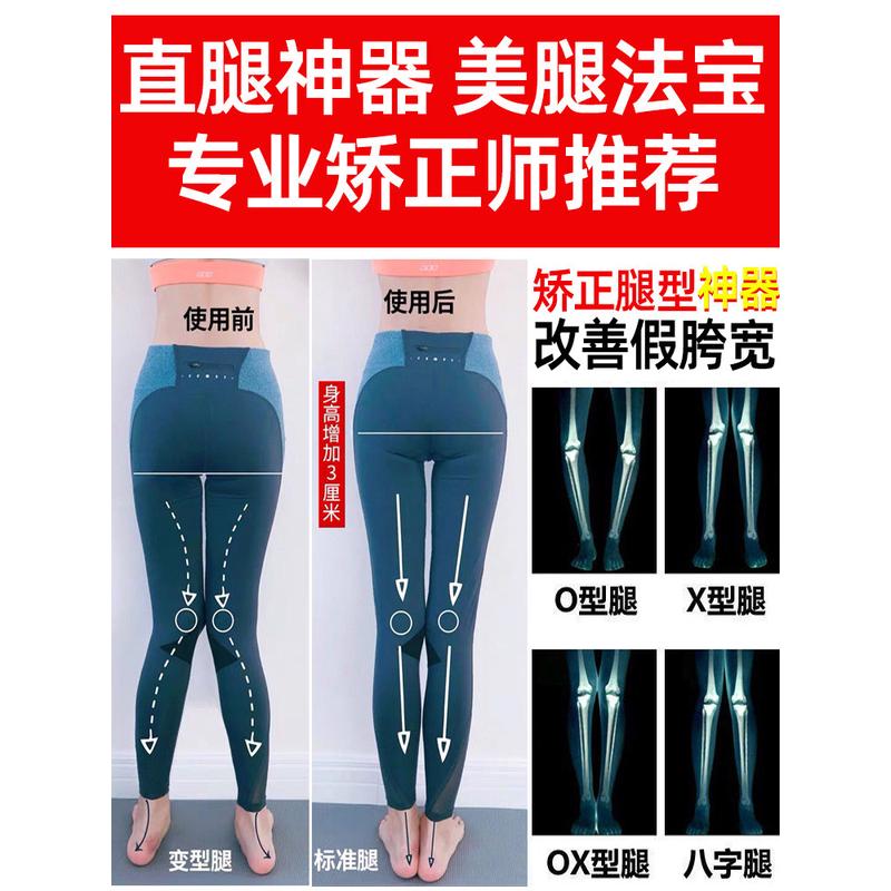 O型腿矫正直腿神器X型腿成人儿童罗圈腿绑带内外八小腿外翻纠正器
