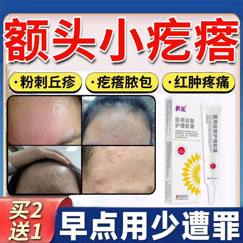 额头下巴小疙瘩痤疮青春痘痘粉刺闭口脂肪粒脓包红肿疼痛医用膏YK