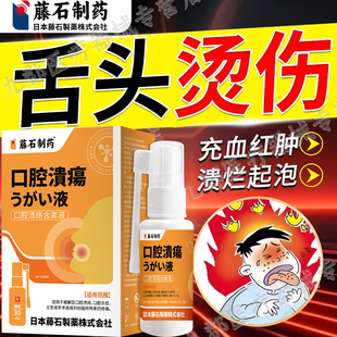 舌头烫伤起水泡疙瘩嘴巴里口舌生疮溃疡糜烂口腔黏膜喷雾剂AH