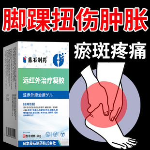 脚踝扭伤远红外凝胶肿胀瘀斑关节疼痛积液辅助恢复消肿止疼YK