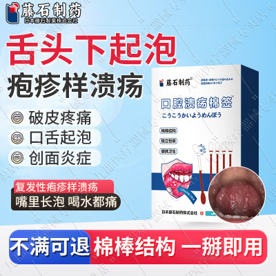 舌头长起泡上火反复儿童一点灵口腔溃疡药房同售棉签棒AH