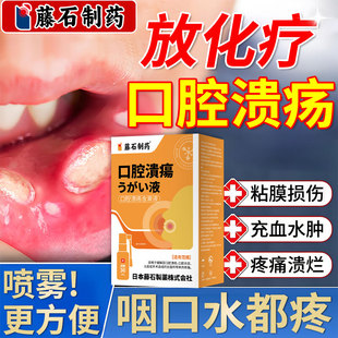 鼻咽放化疗后口腔溃疡液口腔疼痛舌头烂口干粘膜损伤糜烂喷雾剂AH