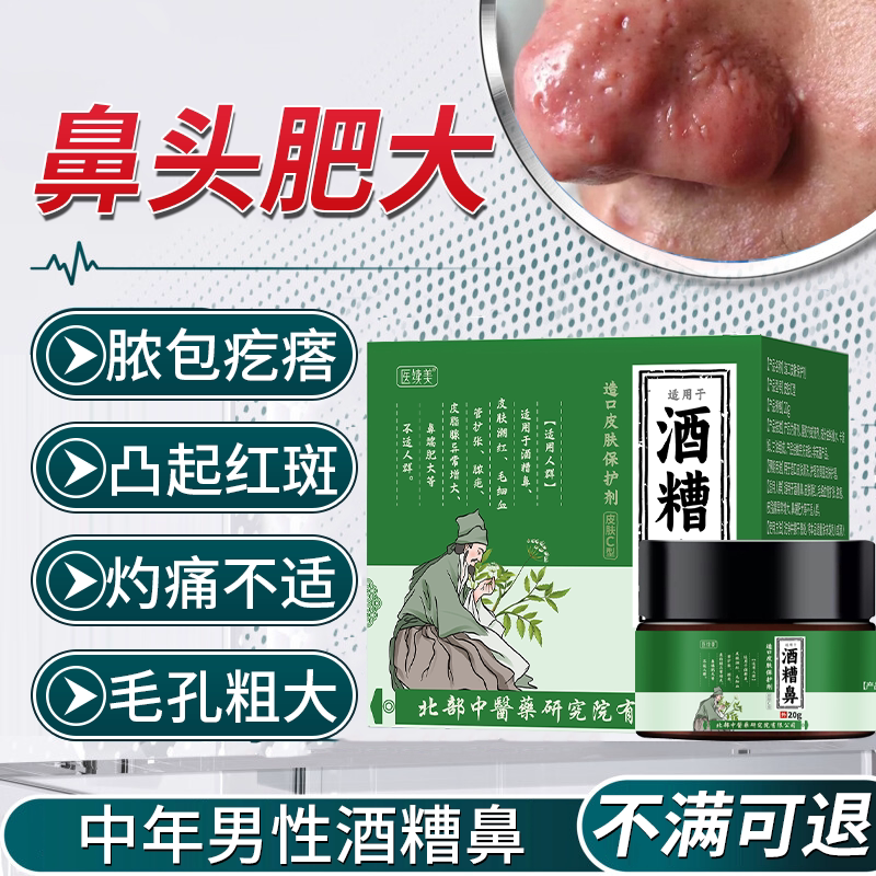 中年男性酒糟鼻子油腻肥大红脸鼻赘增生红斑毛孔粗大去红血丝膏oo