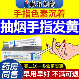 抽烟手指发黄去除手上烟渍色素沉着熏黑关节黄印烟味美白神器YK