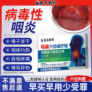 病毒性咽炎红肿痛干痒咳嗽咽喉异物感慢性咽炎药监认证穴位贴YK