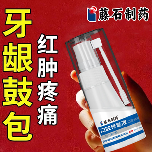 牙根尖周炎牙龈鼓包增生瘘管用红肿疼痛出血龋齿口腔护理喷剂专YK
