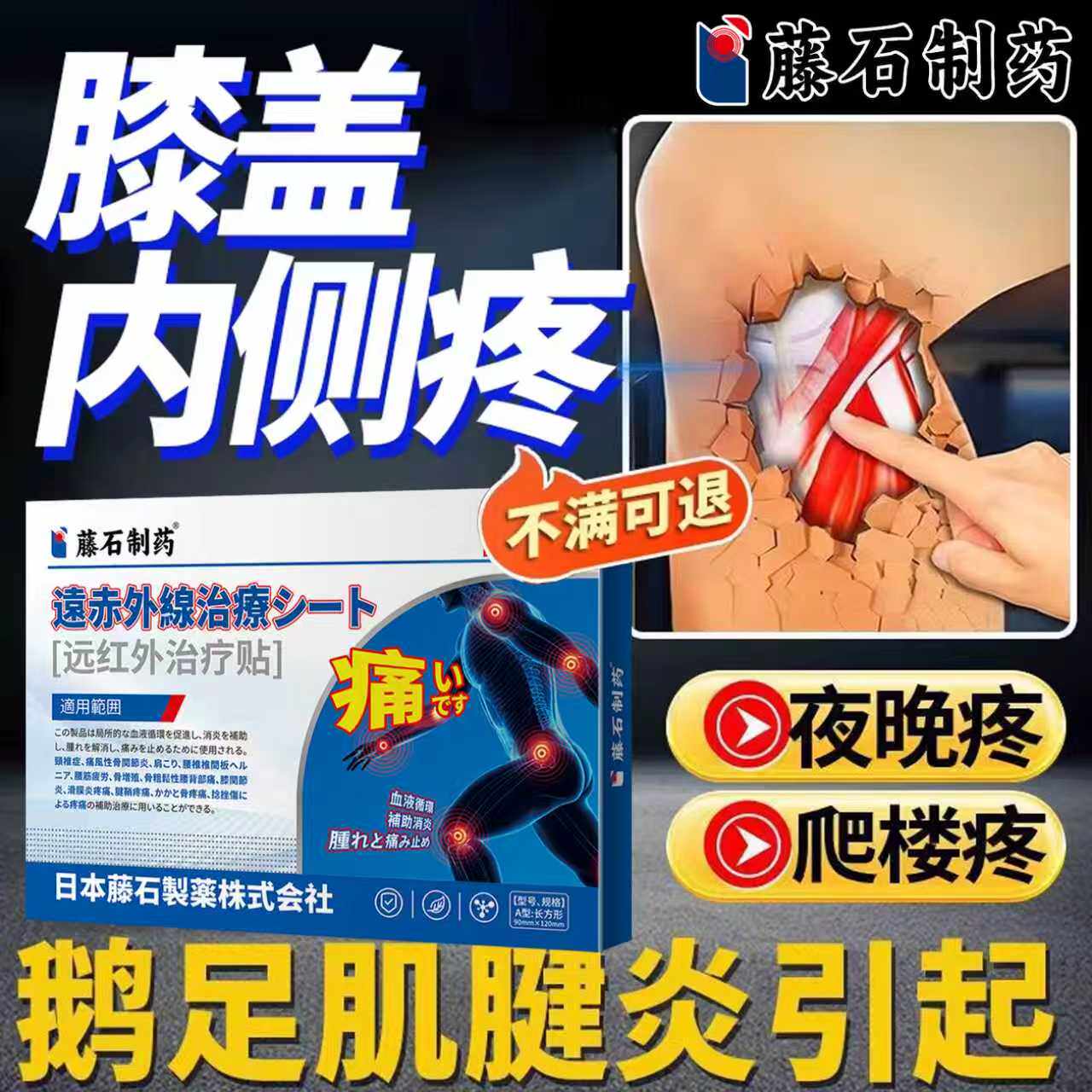 膝盖内侧疼关节筋疼痛积液积水髌腱滑囊炎鹅足肌腱炎可搭膏药贴AH