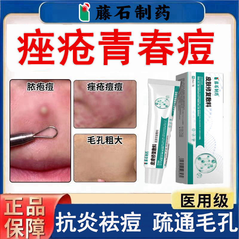 藤石制药座疮青春痘凝胶医用级抗炎祛痘疏通毛孔缓解皮炎湿疹YK