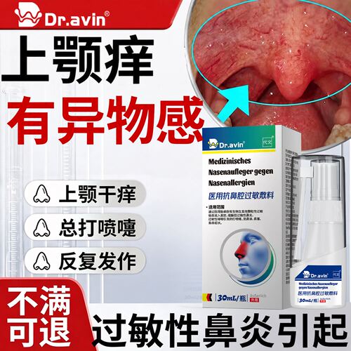 过敏性鼻炎上颚痒喷剂喉咙痒干咳异物感打喷嚏流鼻涕冷空气过敏wj