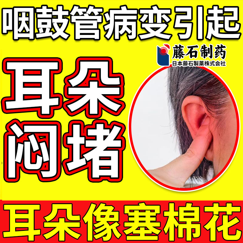 耳朵闷堵咽鼓管病变堵塞流脓流水可搭咽鼓管吹张器分泌性中耳炎AH