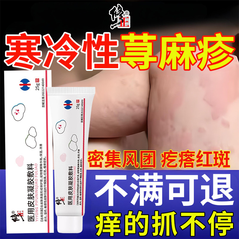 冷性荨麻疹密集风团疙瘩红斑