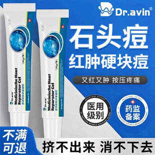 红肿石头痘硬块痘结节囊肿脓包痤疮姨妈上火痘药红肿监备案膏AH