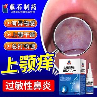 上颚痒过敏性鼻炎口腔喉咙痒打喷嚏流鼻涕秋季冷空气过敏喷雾剂AH