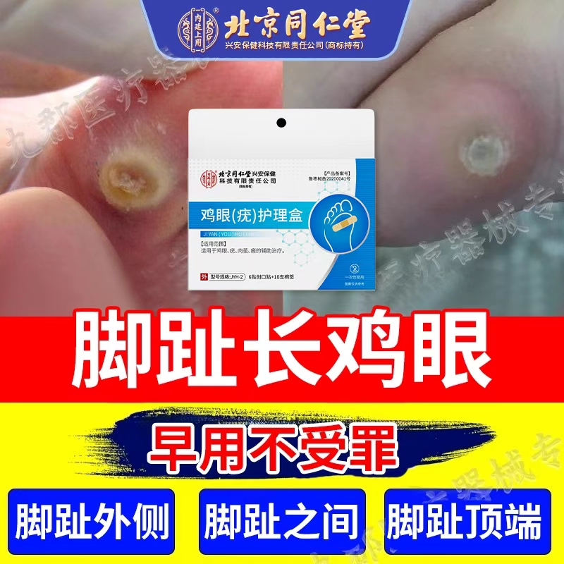 脚趾上长鸡眼脚底后跟上跖疣老茧贴脚钉肉刺正品药房同售AH