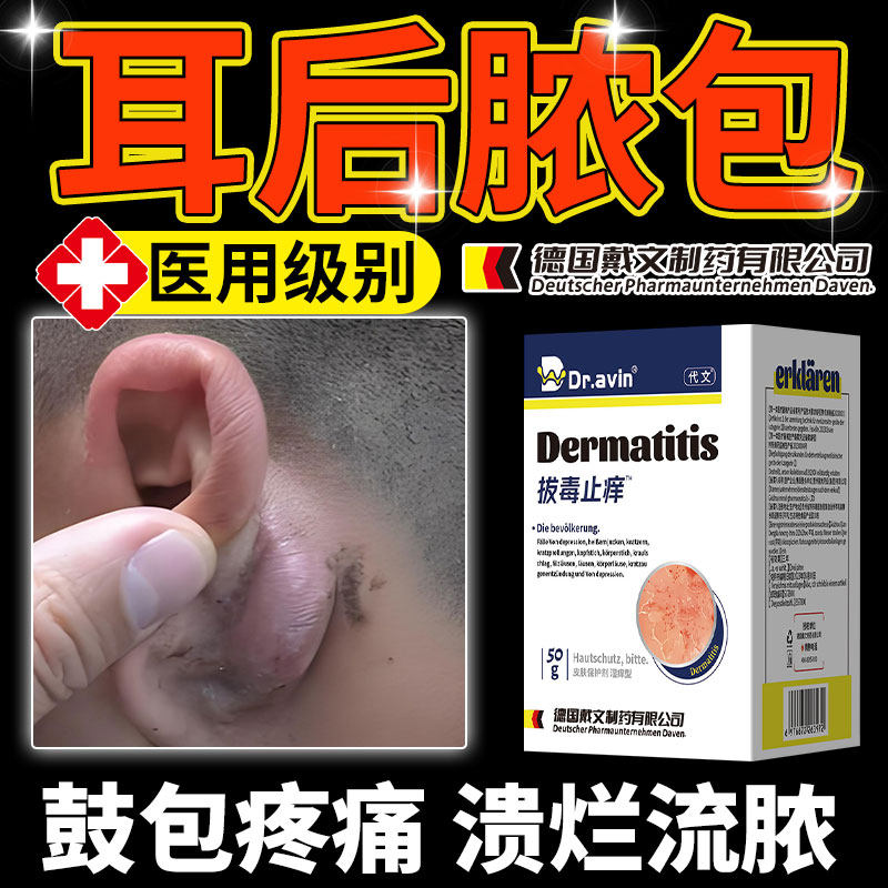 耳后囊肿耳朵皮脂腺囊肿膏去除火疖子皮下脂肪瘤疙瘩鼓包脓包ah
