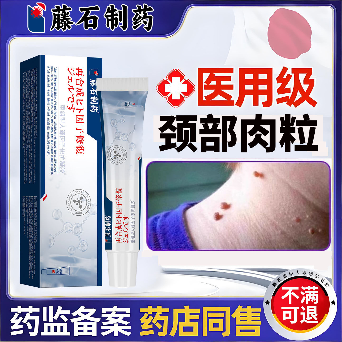 HPV软膏扁平疣凝胶脖子上小肉粒去疙瘩瘊子颈部丝状疣工具皮赘wj