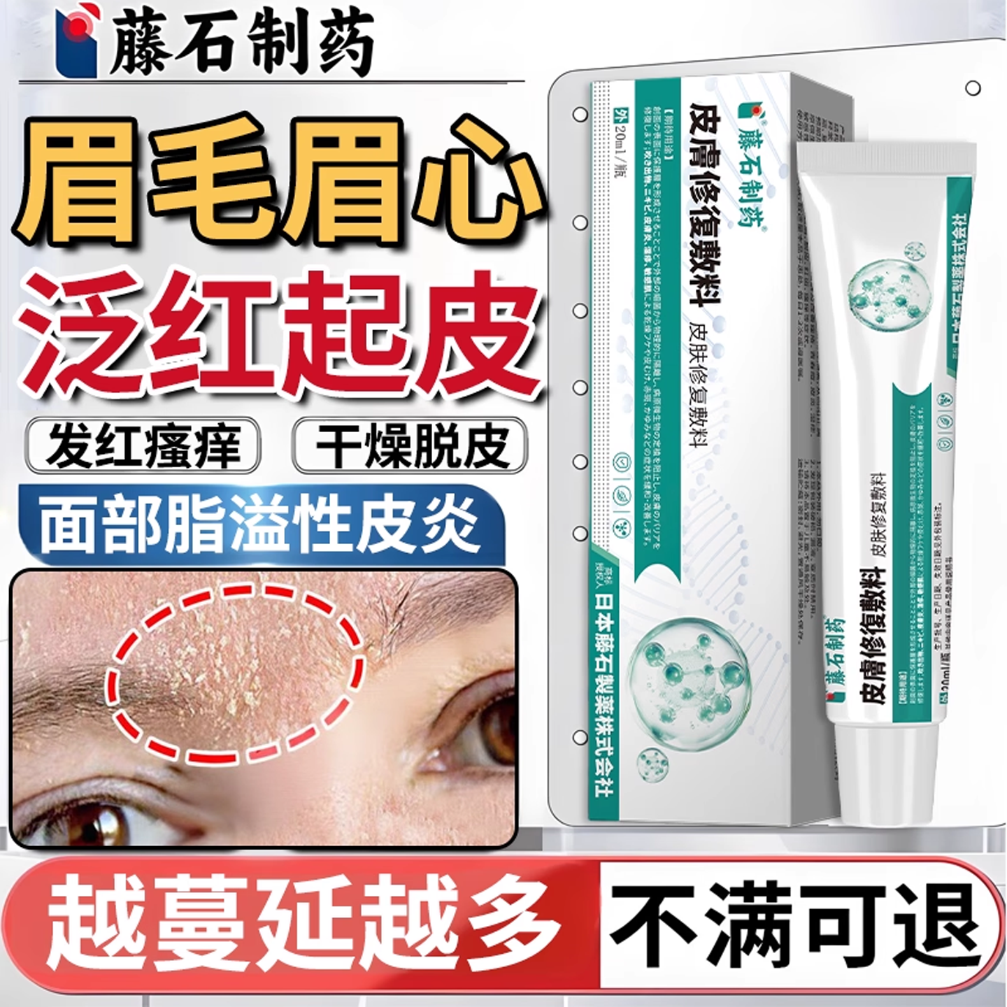 面部脂溢性皮炎修复软膏