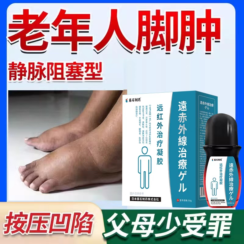 老年人脚肿喷剂老年人消肿浮肿脚疼用什么药好脚部水肿小腿水肿AH