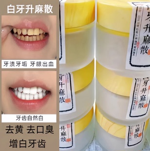 杭州一医院【白牙升麻散】牙渍牙垢 牙龈出血 口异味 增白牙齿