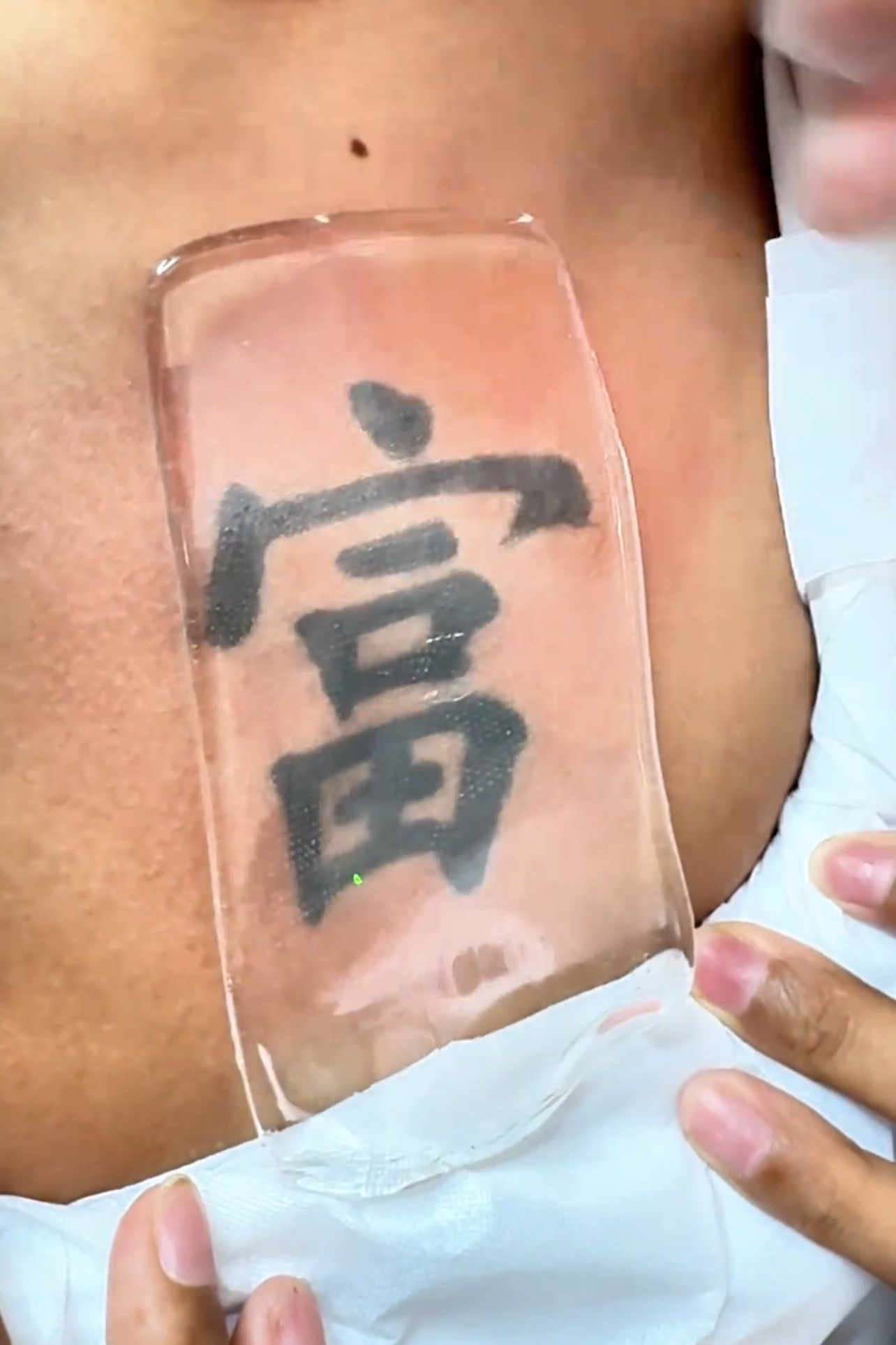 辅助激光洗纹身脱毛防止皮肤损伤专用新款冰凉贴洗纹身专用补丁贴